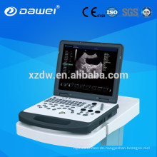 tragbare Doppler-Ultraschall-Maschine &amp; Laptop Farb-Doppler-Ultraschall-Scanner